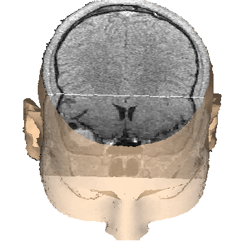 Brain